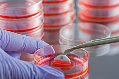 Global Tissue Transplantation Market Drivers