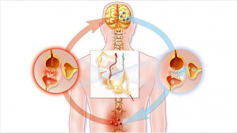 Neuropathic Pain Market Size 2022 Review, Growth Strategy, Developing Technologies and Forecast by 2029