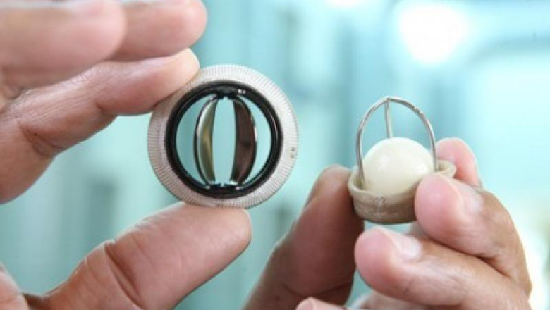 North America is found to be the Largest Market for the Prosthetic Heart Valve