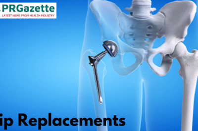 What's new in the world of hip replacements