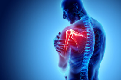 Can frozen shoulder be the symptom of arthritis?