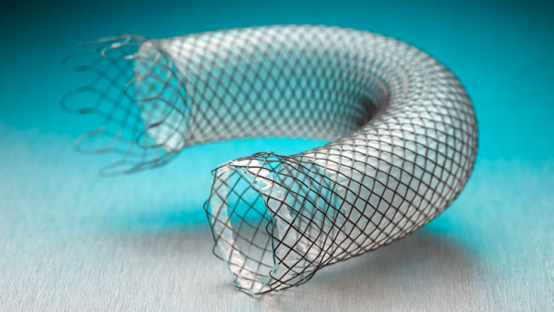 Gastrointestinal Stents Market from 2020 To 2026, Application Scope, Growth Drivers and Insights