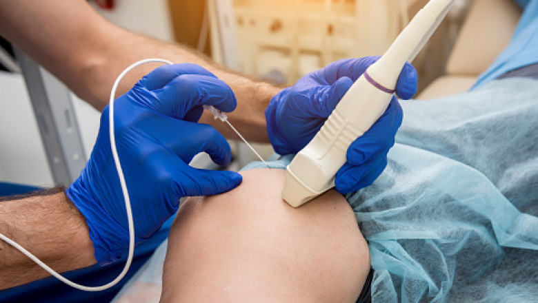 Global Radiofrequency Ablation Devices Market- Explore the 2021 to 2030 Trends, Analysis, Forecasts and Assessment