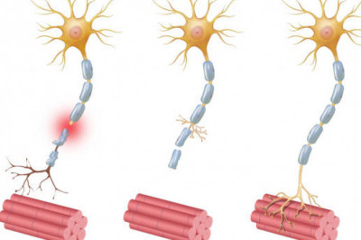 Nerve Repair and Regeneration Market Size will Observe Substantial Growth by 2027