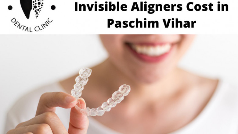Best Invisalign Treatment in Paschim Vihar