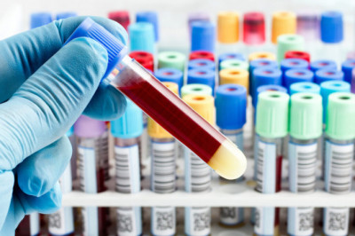 Global Blood Coagulation Tubes Market Overview