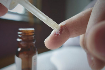 SALICYLIC ACID MARKET - GROWTH, TRENDS, COVID-19 IMPACT, AND FORECASTS (2022 – 2027)