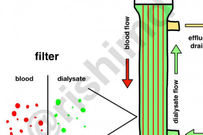 What happens to my blood throughout the Hemodialysis filtering process?