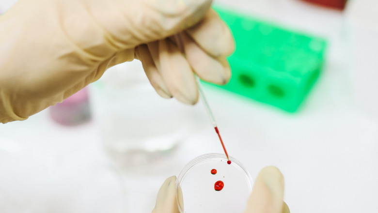 Importance of hba1c blood test