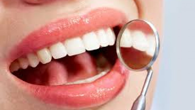 What Will You Expect During Laser Gingivectomy Surgery?
