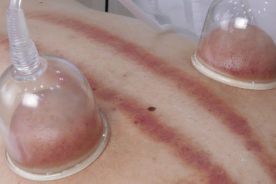 Benefits of Vacuum Therapy Machines