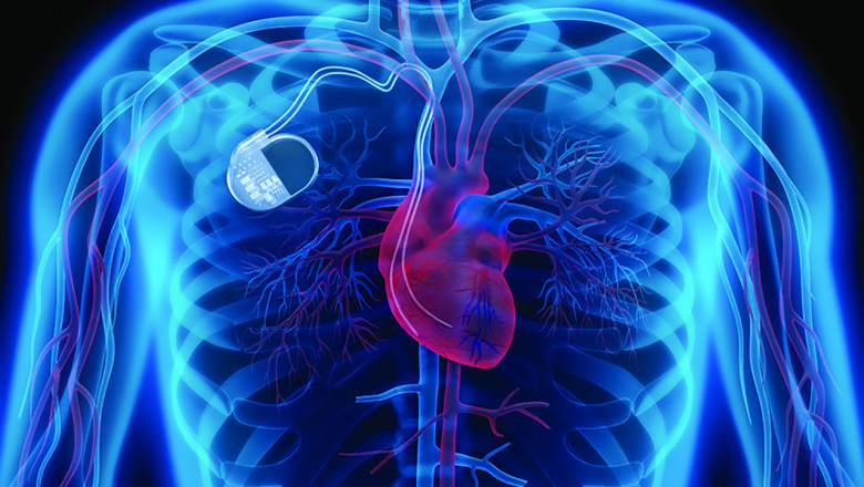 Implantable Medical Devices Market updates, demand analysis, and expected growth forecast 2021-2027