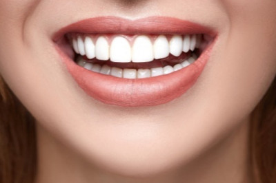 Teeth Whitening Waterloo