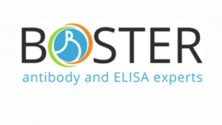 Human Cortisol ELISA Kit