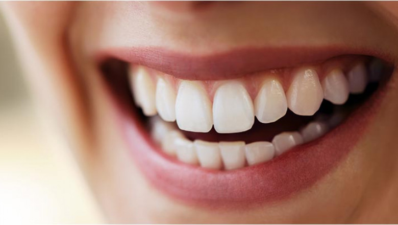 How Dental Crowns Are Made Of?