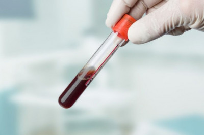 Artificial Blood Market Overview