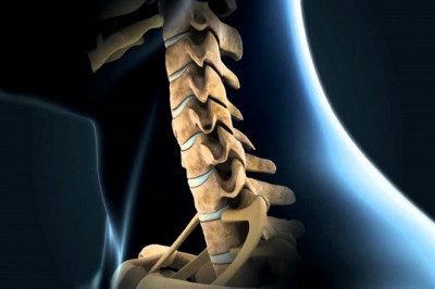 Cervical Total Disc Replacement Devices Preserve More Normal Neck Motion