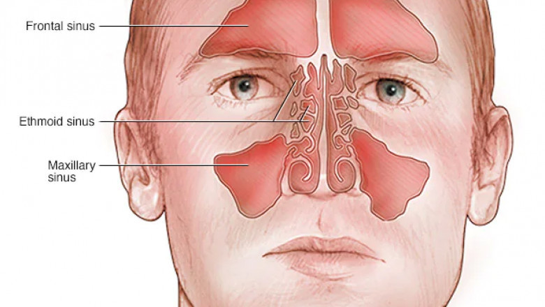Acute Sinusitis Treatment Market Value, Get Market Research, Business Risk & Industry Analysis Reports 2027