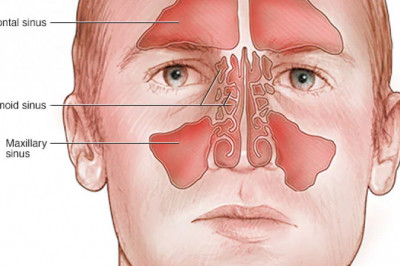 Acute Sinusitis Treatment Market Value, Get Market Research, Business Risk & Industry Analysis Reports 2027