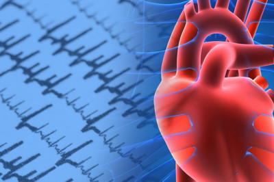 Atrial Fibrillation Market Drivers