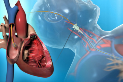 Impact of Covid-19 on Pulmonary Arterial Hypertension Market