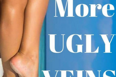 One Stop Clinic For Varicose Veins