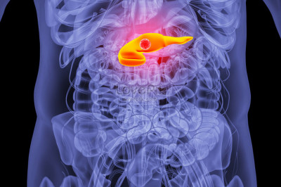 Causes of Cushings Syndrome