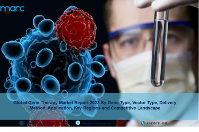 Gene Therapy Market Overview, Size, Share, Trends, Key Vendors, Regions Demand, Growth and Forecast to 2027