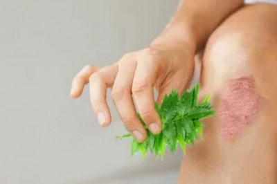 Eczema Therapeutics Market Analysis to 2021 - 2027 | Research Informatic