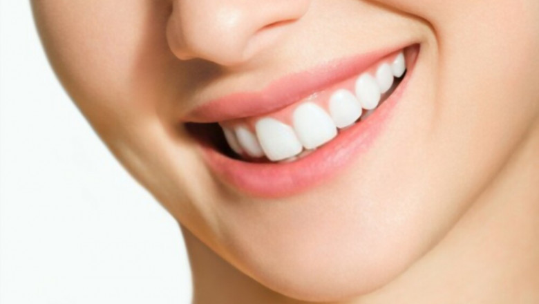 8 Amazing Benefits of Teeth Whitening