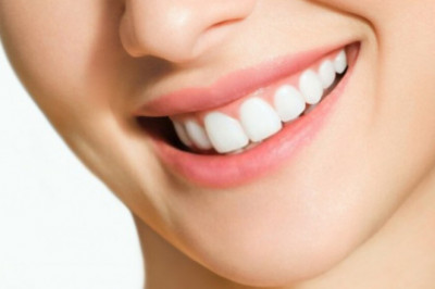8 Amazing Benefits of Teeth Whitening