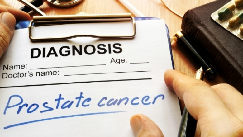 Colorectal Cancer Screening Exams