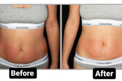 Best Cavitation Machine For You