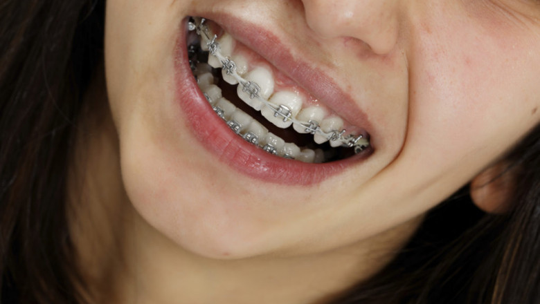 Dental treatment in Satellite