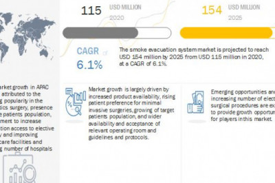 Smoke Evacuation Systems Market Worth USD 154 million by 2025 : Latest Technologies