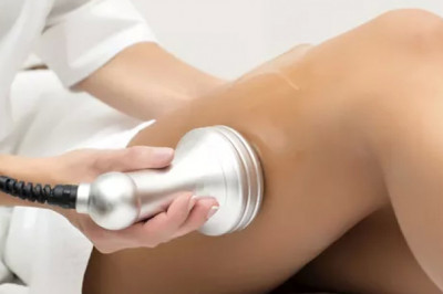 Does cupping vacuum therapy last forever?