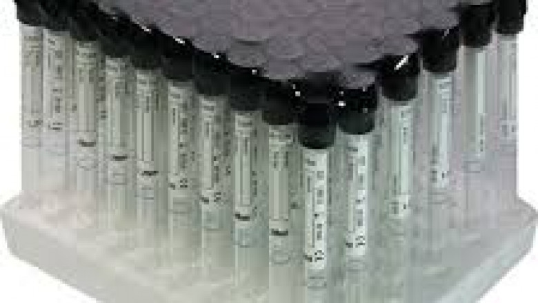 What is the ESR Tubes Wintrobe approach, exactly?