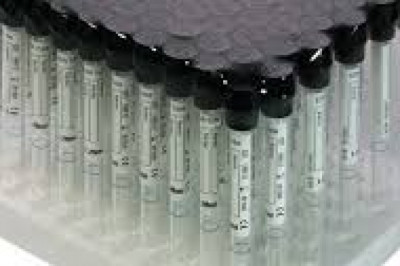 What is the ESR Tubes Wintrobe approach, exactly?