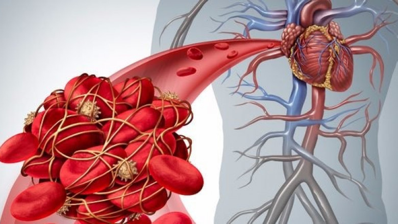 Hematologic Malignancies Market  Share, Size, Trends, Growth and Opportunities by 2021-2026