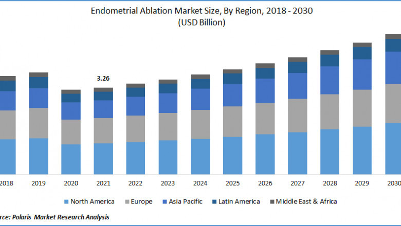 Endometrial Ablation Market Size Estimation Research Report, 2022-2030