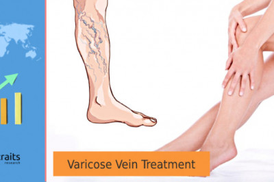 Varicose Vein Treatment Market Analysis; Future Scope and Price Analysis By 2027