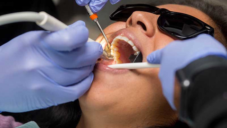 Can Periodontitis Be Cured?