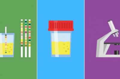 Urinalysis Market Share by 2025: Global and Regional Analysis and Products made possible