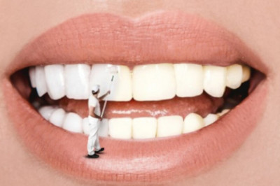 Whiten Your Yellow Smile in Tomball And Its Causes