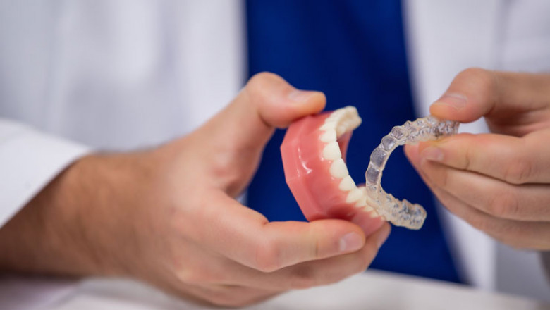 Why Should You Consider Dental Implants?