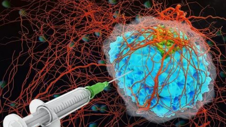 Global Bone Cancer Drug Market– Impact of Coronavirus (COVID-19) Pandemic