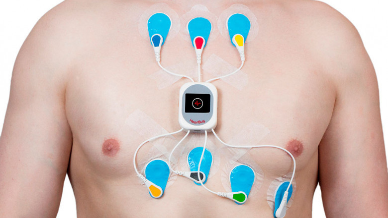 How do Electrocardiogram (ECG) Devices machines work?