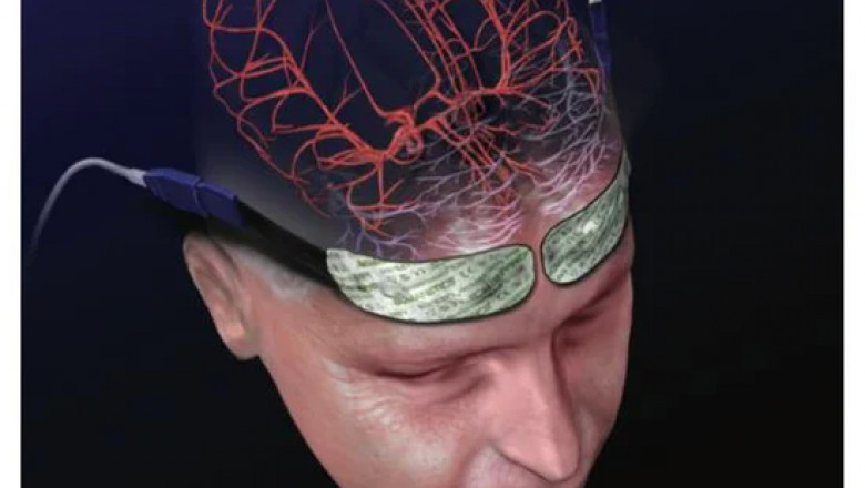 What is the definition of normal Cerebral Somatic Oximeters?
