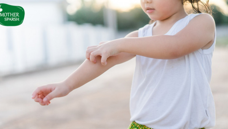 Summer Skin Care Tips for Babies