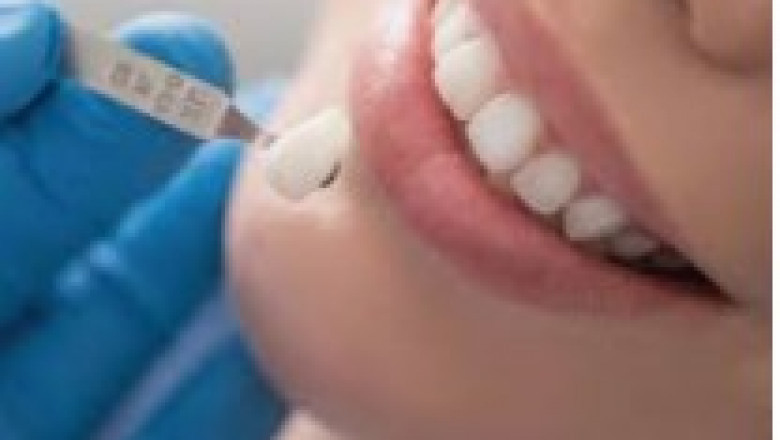 Precisely exactly how to Select the greatest Oral Specialist for Your Teeth Needs